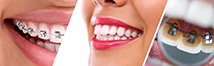 IMAGE IS USED FOR ORTHODONTICS IN DENTAL SPA- BEST DENTIST IN PATNA